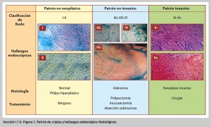 FIGURA 1. Patrón de criptas y hallazgos endoscópico-histológicos.