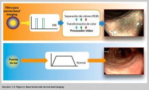 FIGURA 3. Base técnica del narrow band imaging.