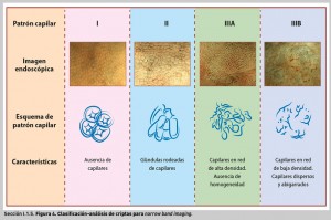 FIGURA 4. Clasificación-análisis de criptas para narrow band imaging.