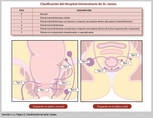 FIGURA 2. Clasificación de Saint James.