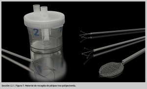 FIGURA 7. Material de recogida de pólipos tras polipectomía.