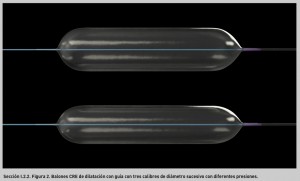 FIGURA 2. Balones CRE de dilatación con guía con tres calibres de diámetro sucesivo con diferentes presiones.