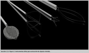 FIGURA 3. Instrumentos útiles para la extracción de cápsula retenida.