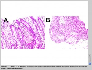 FIGURA 11. EC. Histología.