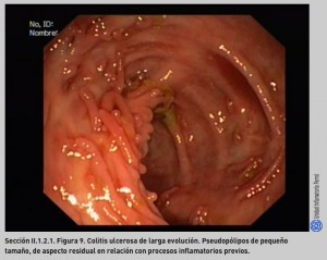 FIGURA 9. CU. fases crónicas