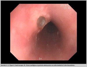 FIGURA 5. Gastroscopia. EC.