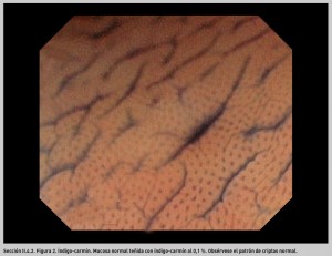 FIGURA 2. Índigo-carmín. Mucosa normal.